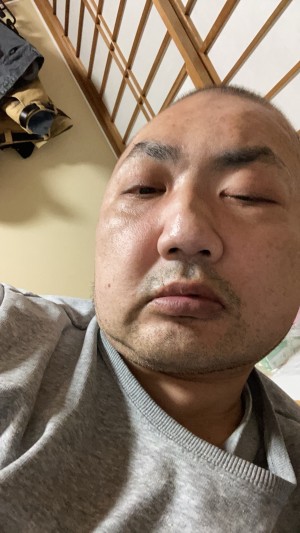 ノッチ